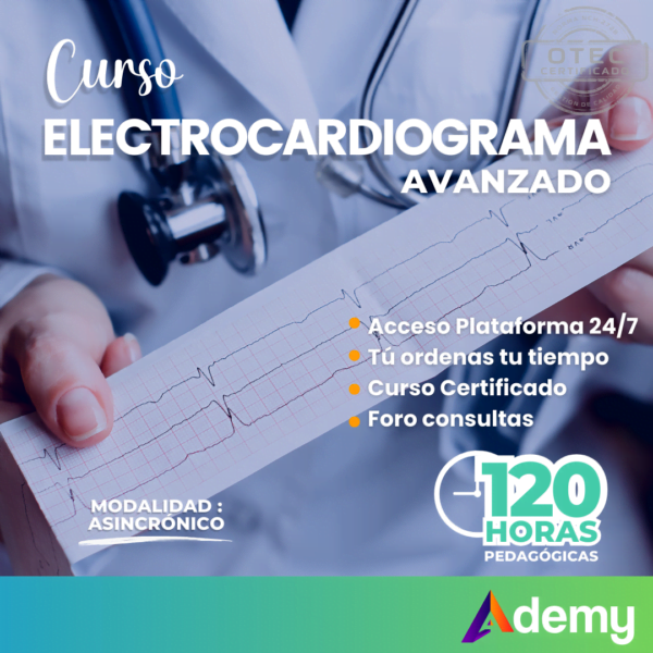 electrocardiograma avanzado